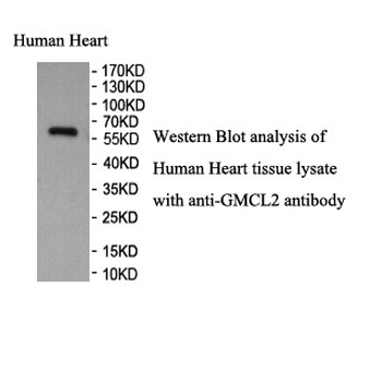 GMCL2 Rabbit Polyclonal Antibody