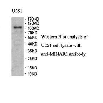 MINAR1 Rabbit Polyclonal Antibody