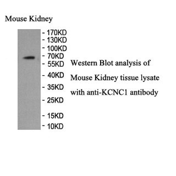 KCNC1 Rabbit Polyclonal Antibody
