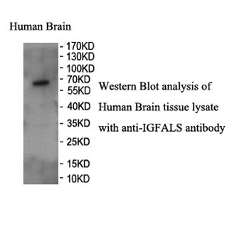 IGFALS Rabbit Polyclonal Antibody