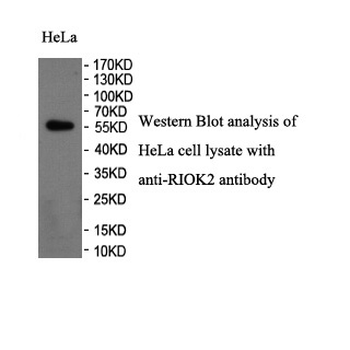 RIOK2 Rabbit Polyclonal Antibody