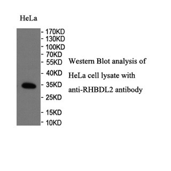 RHBDL2 Rabbit Polyclonal Antibody