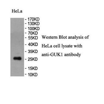 GUK1 Rabbit Polyclonal Antibody
