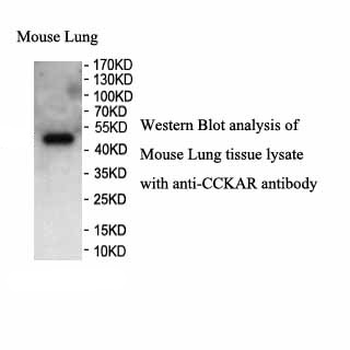 CCKAR Rabbit Polyclonal Antibody