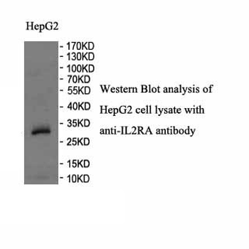 IL2RA Rabbit Polyclonal Antibody