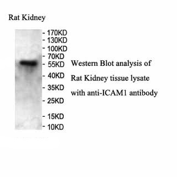 ICAM1 Rabbit Polyclonal Antibody