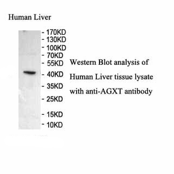 AGXT Rabbit Polyclonal Antibody