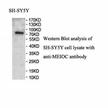 MEIOC Rabbit Polyclonal Antibody
