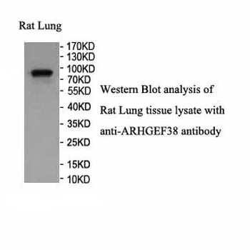 ARHGEF38 Rabbit Polyclonal Antibody
