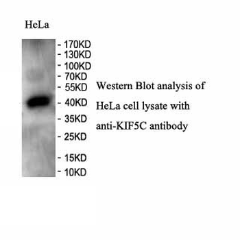 KIF5C Rabbit Polyclonal Antibody