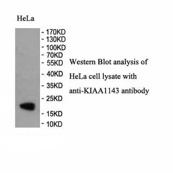 KIAA1143 Rabbit Polyclonal Antibody