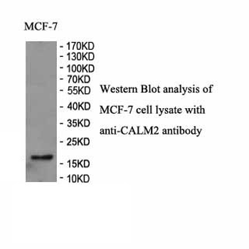 CALM2 Rabbit Polyclonal Antibody
