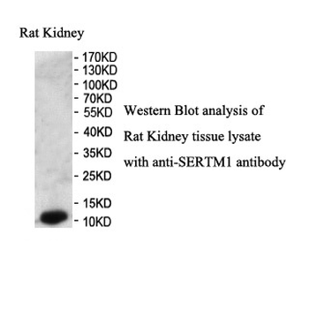 SERTM1 Rabbit Polyclonal Antibody