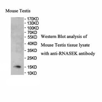 RNASEK Rabbit Polyclonal Antibody