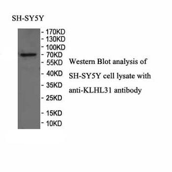 KLHL31 Rabbit Polyclonal Antibody