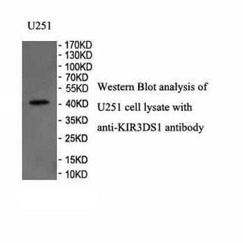 KIR3DS1 Rabbit Polyclonal Antibody