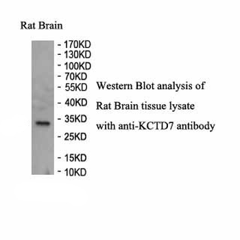 KCTD7 Rabbit Polyclonal Antibody