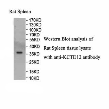 KCTD12 Rabbit Polyclonal Antibody