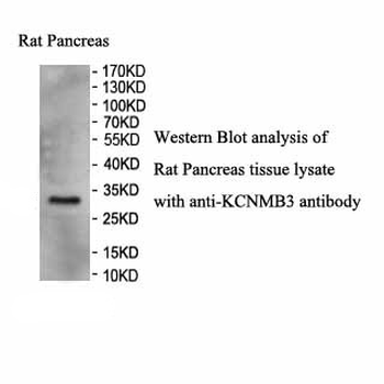 KCNMB3 Rabbit Polyclonal Antibody