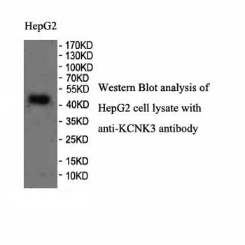 KCNK3 Rabbit Polyclonal Antibody