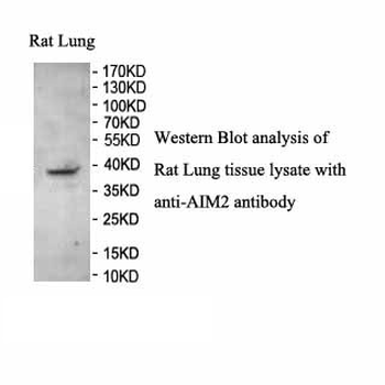 AIM2 Rabbit Polyclonal Antibody