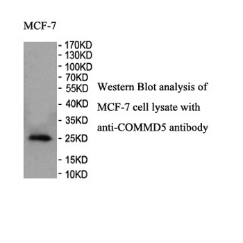 COMMD5 Rabbit Polyclonal Antibody