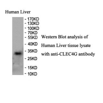 CLEC4G Rabbit Polyclonal Antibody