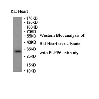 PPAPDC2 Rabbit Polyclonal Antibody