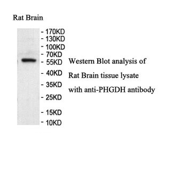 PHGDH Rabbit Polyclonal Antibody