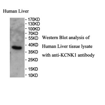 KCNK1 Rabbit Polyclonal Antibody