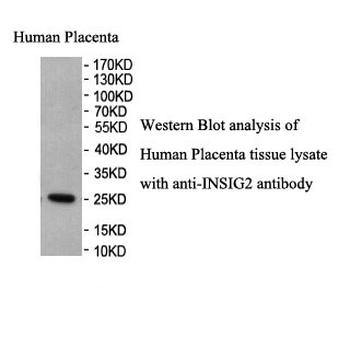 INSIG2 Rabbit Polyclonal Antibody