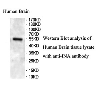 INA Rabbit Polyclonal Antibody