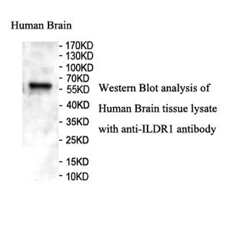 ILDR1 Rabbit Polyclonal Antibody