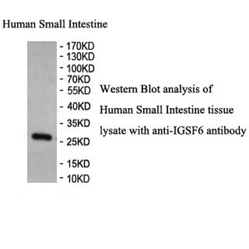 IGSF6 Rabbit Polyclonal Antibody