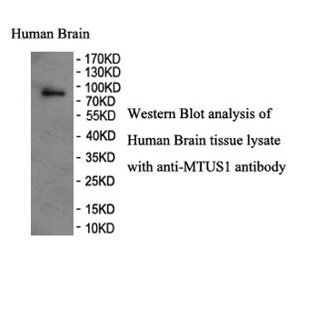 MTUS1 Rabbit Polyclonal Antibody