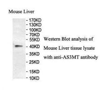 AS3MT Rabbit Polyclonal Antibody