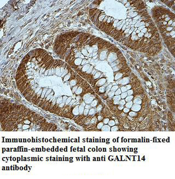 GALNT14 Rabbit Polyclonal Antibody