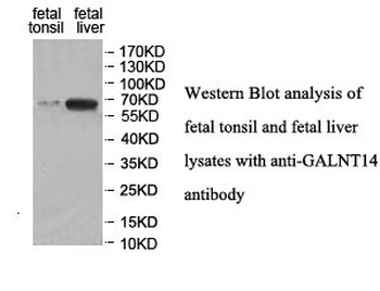GALNT14 Rabbit Polyclonal Antibody