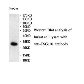 TSG101 Rabbit Polyclonal Antibody