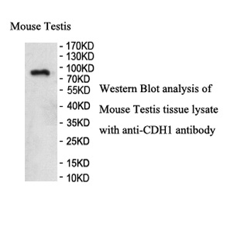 CDH1 Rabbit Polyclonal Antibody