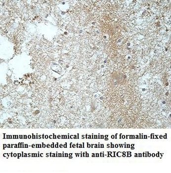 RIC8B Rabbit Polyclonal Antibody