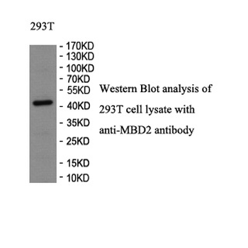 MBD2 Rabbit Polyclonal Antibody