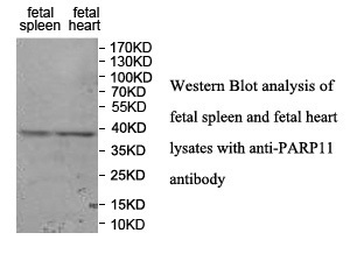PARP11 Rabbit Polyclonal Antibody