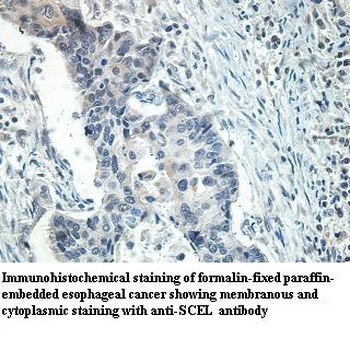 SCEL Rabbit Polyclonal Antibody