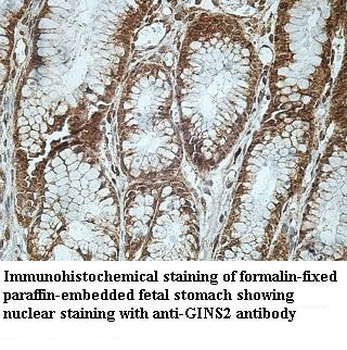 GINS2 Rabbit Polyclonal Antibody
