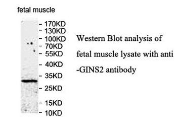 GINS2 Rabbit Polyclonal Antibody