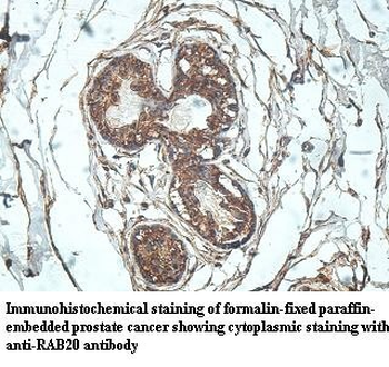 RAB20 Rabbit Polyclonal Antibody