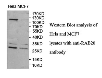 RAB20 Rabbit Polyclonal Antibody