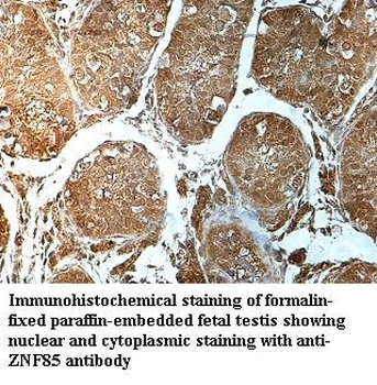 ZNF85 Rabbit Polyclonal Antibody