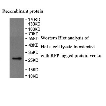 RFP Rabbit Polyclonal Antibody